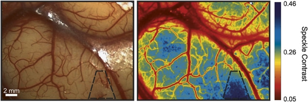 human cortex captured by a surgical microscope