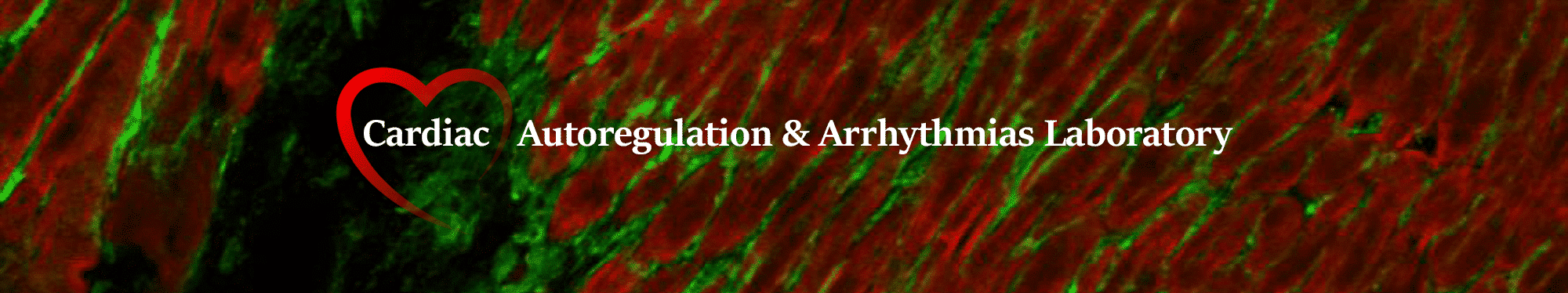 cardiac autoregulation  arrhythmias lab
