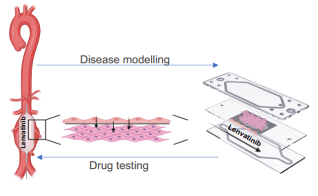 Scheme represents the utilization of the Artery-on-a-Chip