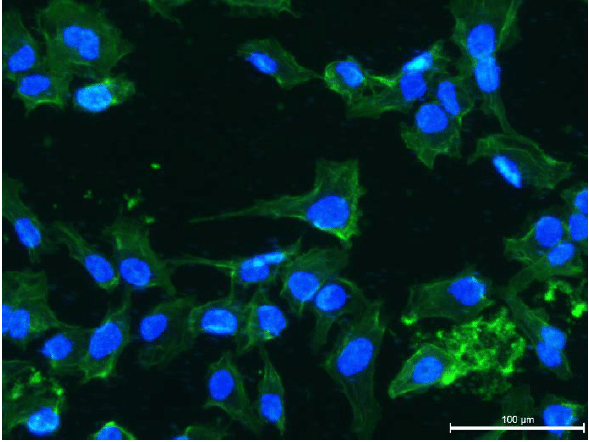 Microscopic view of the bone on chip study