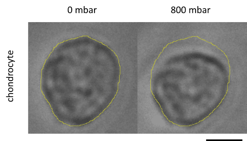 Chondrocyte deformation