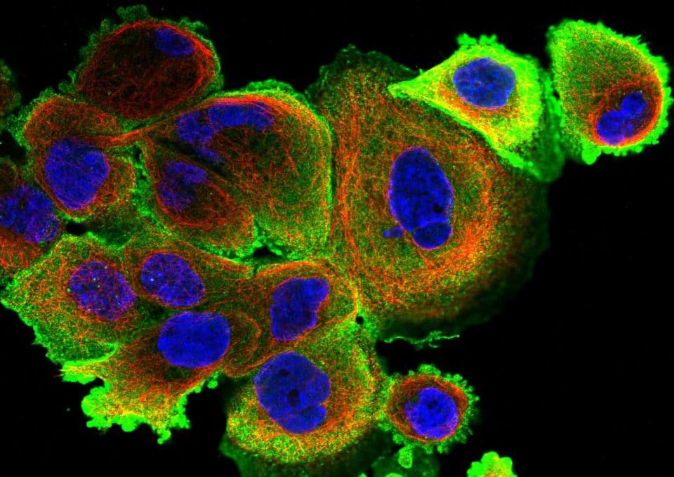 Microfluidics for Cell Biology and immunostaining