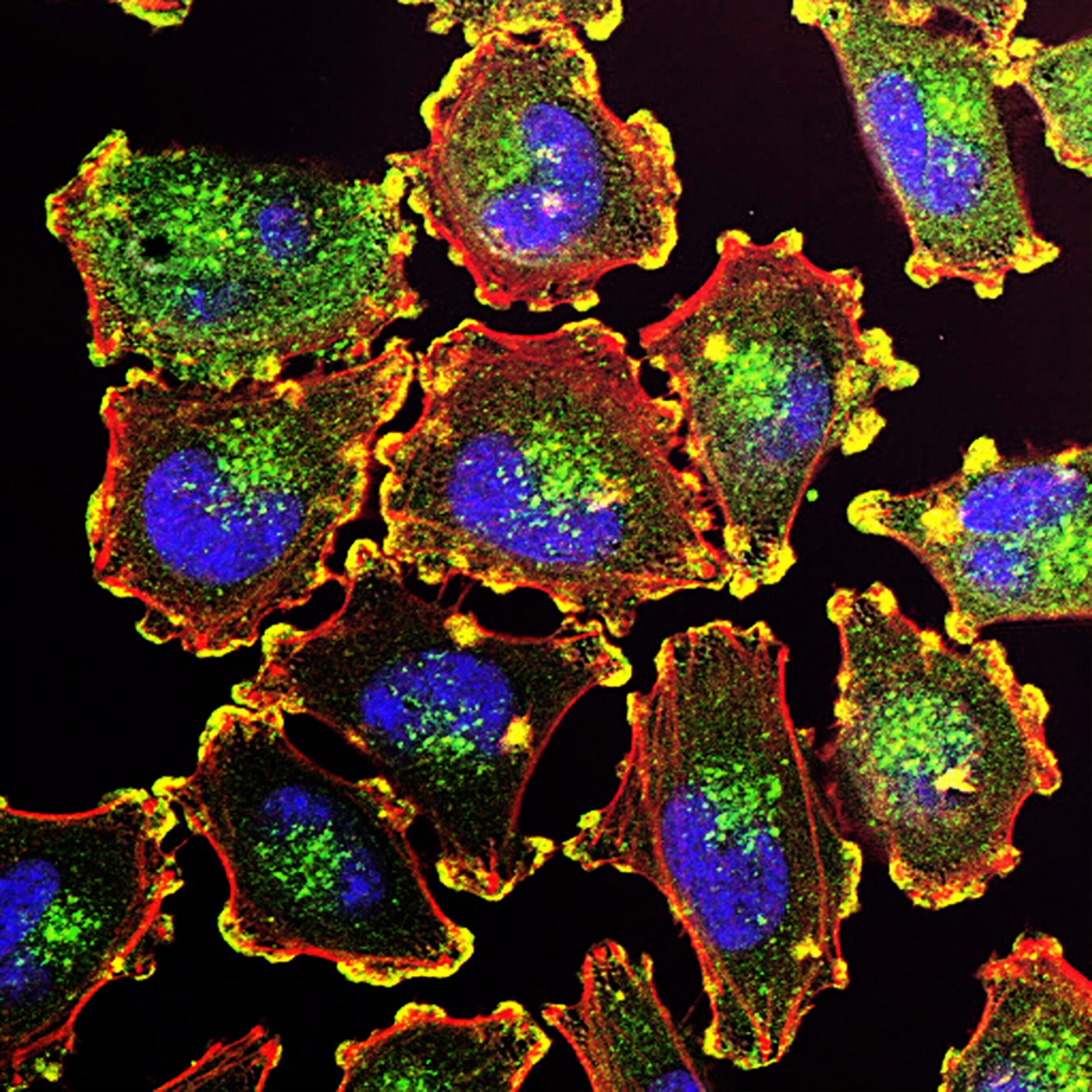 Microfluidic market for life science