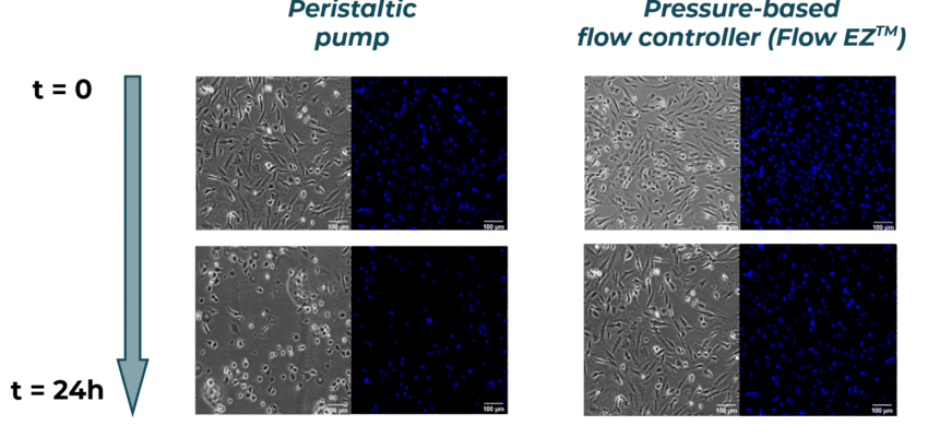 pressure-vs-peristaltic