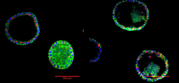 Prostate organoid culture under fluorescent microscope