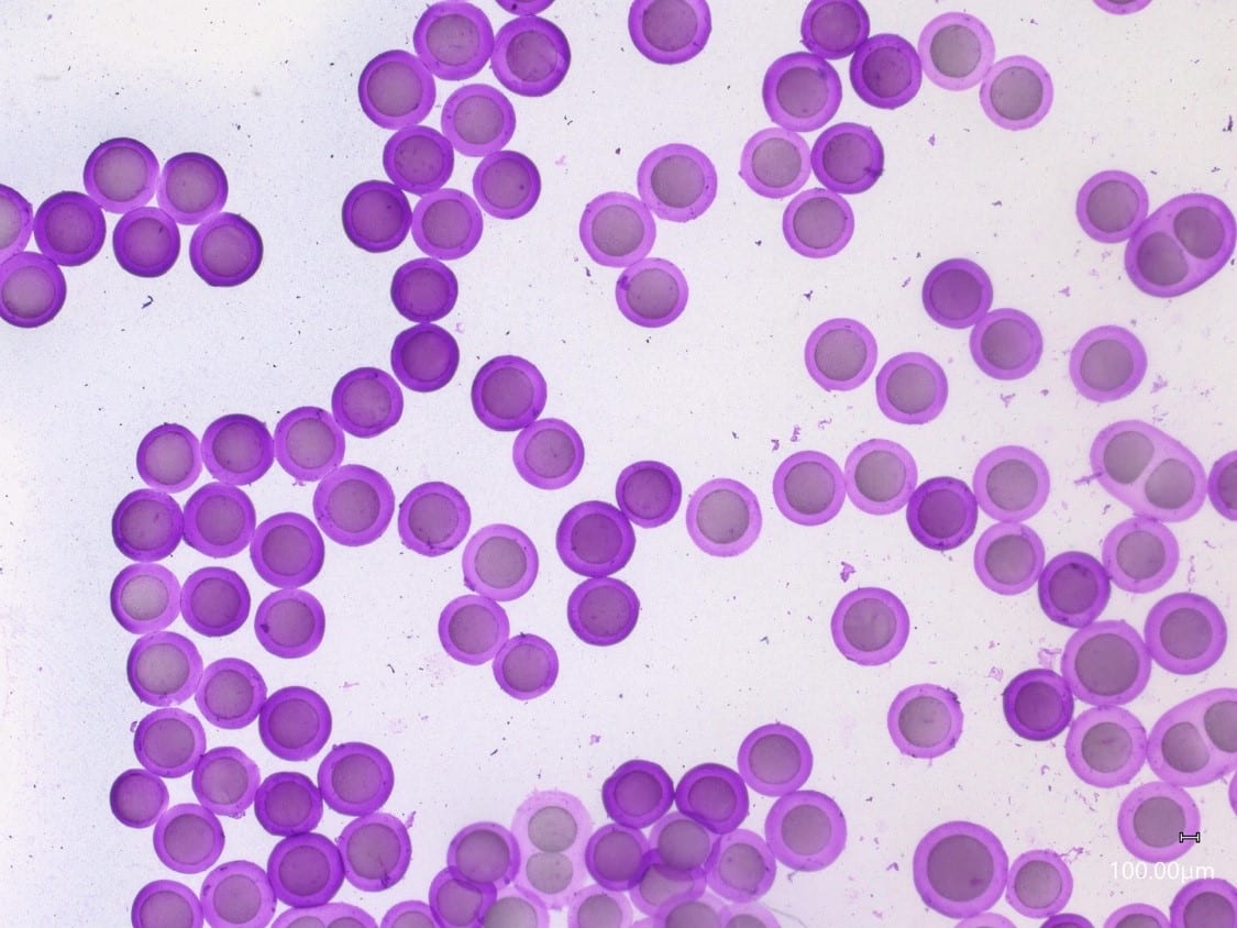 Agarose microcapsules in suspension zoom