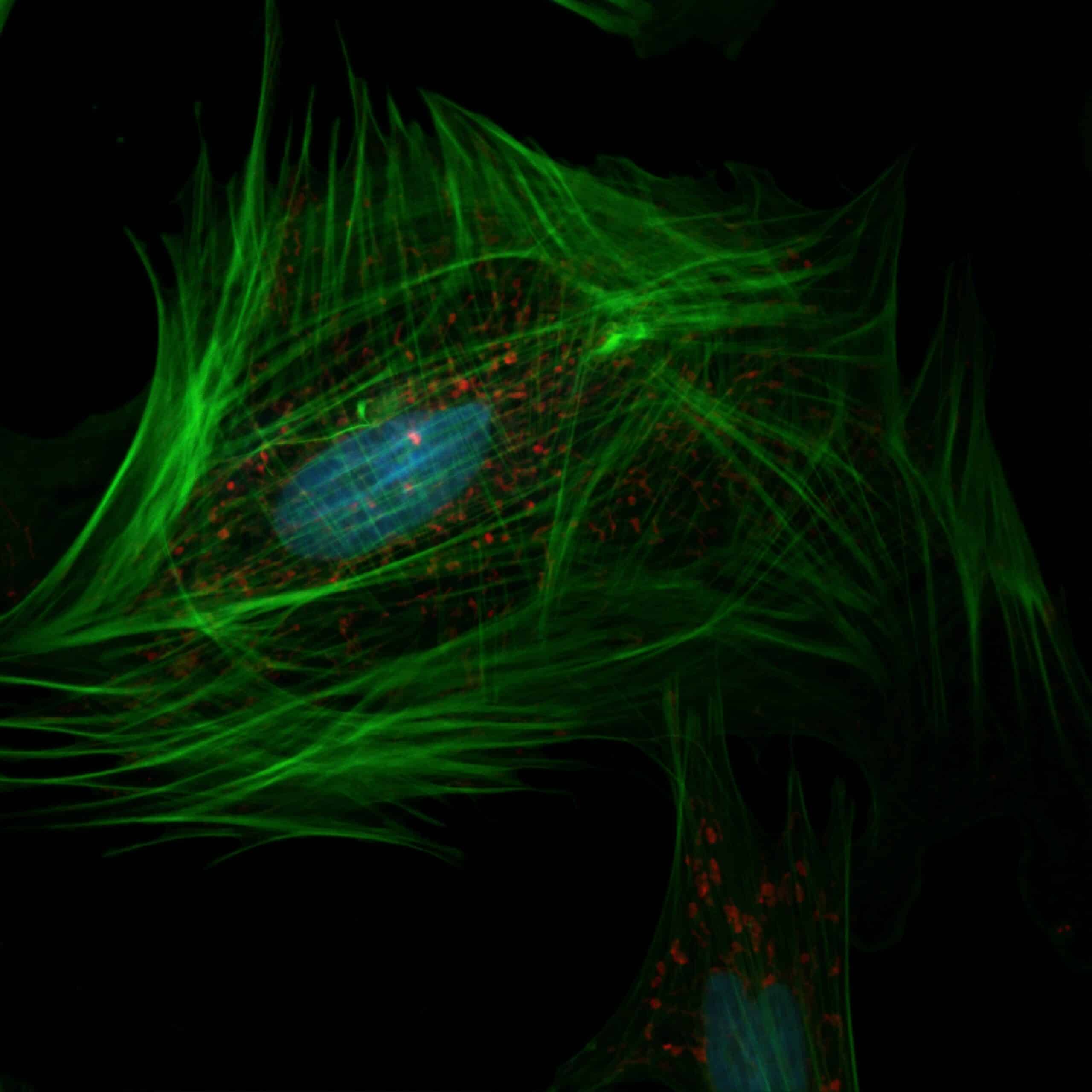 localization microscopy