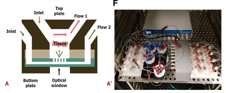 Cancer-on-a-Chip system