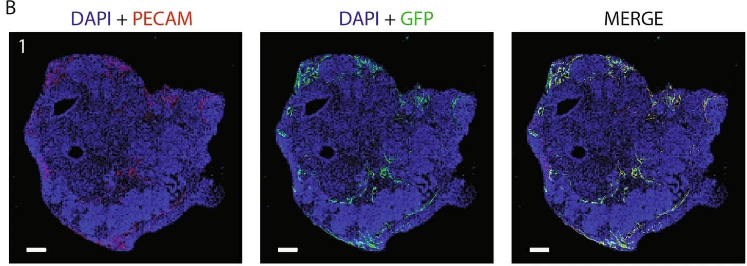 immunofluorescent organoids co-cultured