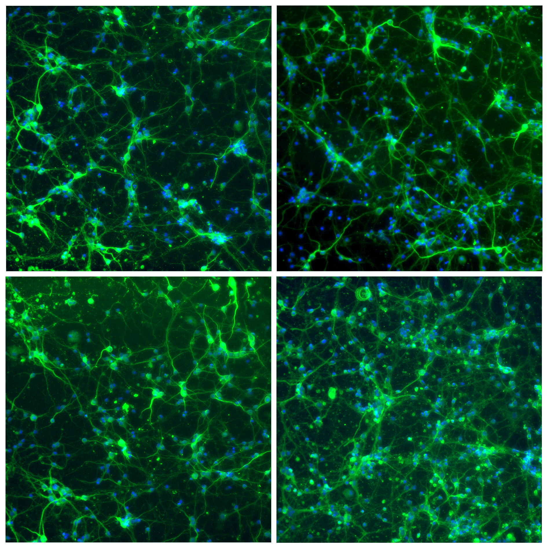 Neuronal cell immunofluorescence