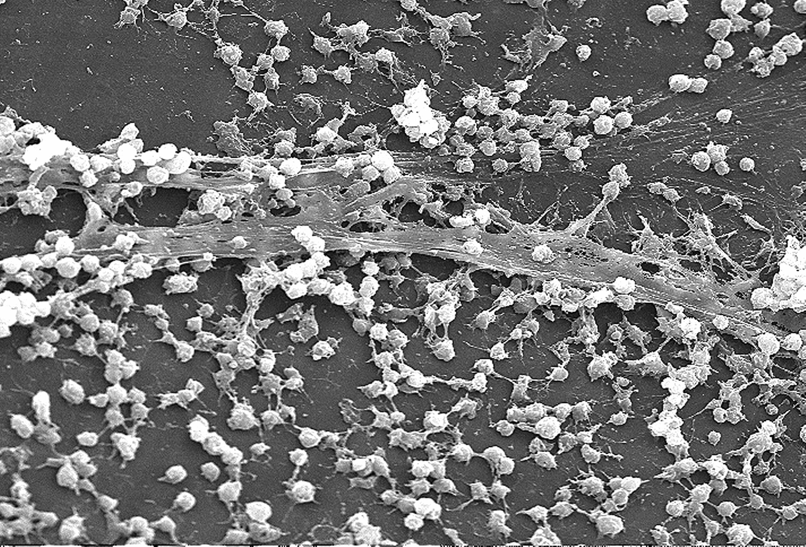 Microscopic image of biofilm on a catheter