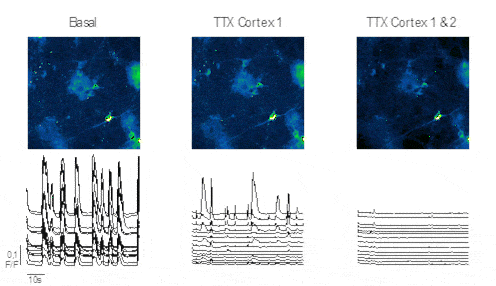 image showing Functional activity of neuron cells after stimulation
