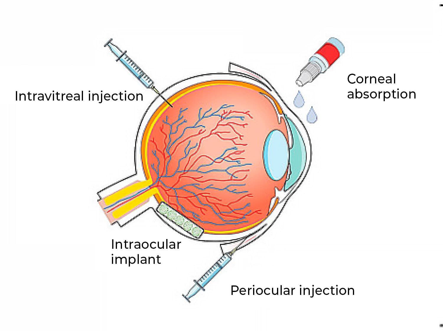 Ocular routes for drug delivery