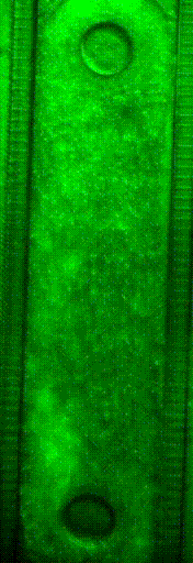 Aria GIF calcium imaging - Fluigent spontaneous rhythmic contractions of the microtissues