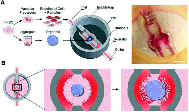 photo of an open organoid